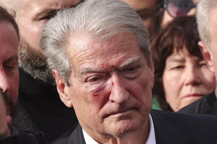 Αλβανία: Θύμα ξυλοδαρμού σε διαδήλωση ο ηγέτης της αντιπολίτευσης Σαλί Μπερίσα