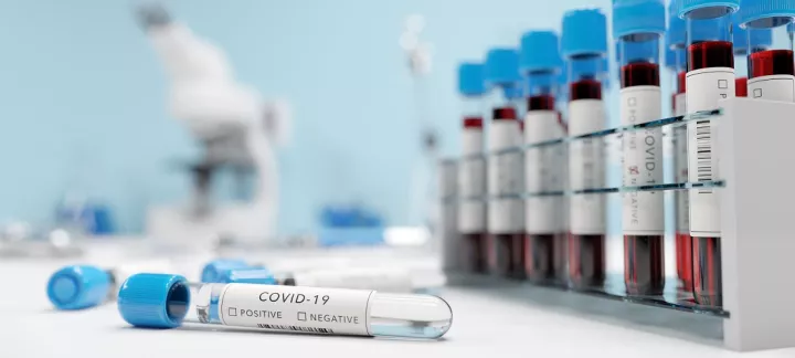 «Όρθρος» Η νέα υποπαραλλαγή Covid που εξαπλώνεται ταχύτατα στη Βρετανία