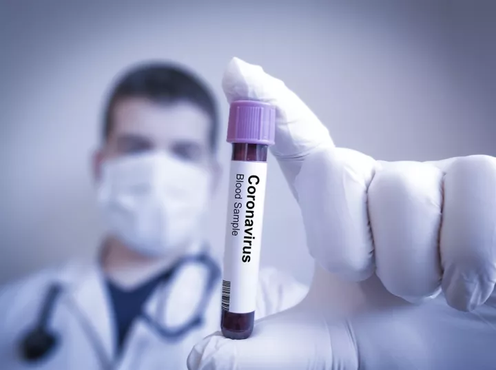 Ξεπέρασαν τους 400.000 οι θάνατοι εξαιτίας της COVID-19 στη Λατινική Αμερική και την Καραϊβική